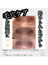 シアー(sHeeR)/毛穴ケア