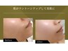 【口コミ割】効果の即効性と継続性に自信あり！光フェイシャルエステ￥6,600