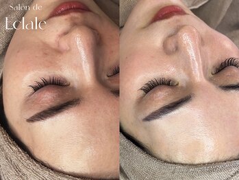 サロンドエクラル(Salon de Eclale wax)/【ちゅるりんお肌】艶肌ワックス