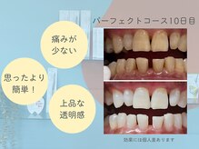 ハモットホワイト(Hamotto White)