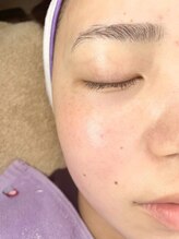 ミリミリビューティラボ(milimili_beautylabo)