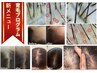 50代からの育毛を促進する【新毛確認コース】