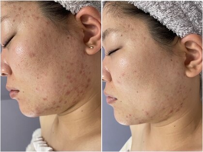 サロン ド ミモザ(Salon de Mimosa)の写真