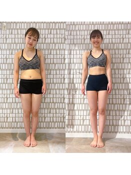 イーストレッチジム 新宿(E-STRETCH GYM)/ビフォーアフター