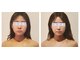 クレイン アキシマ(crane akishima)の写真/人気の小顔矯正★むくみ・左右差・歪みが気になる方も調整します◎憧れのすっきりした輪郭に♪