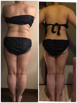 デール(R:DeeL)/ブライダルエステ