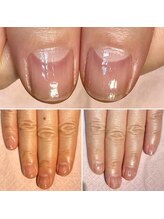 ココデネイル(cocode nail)/悩み：爪が割れる…(50代前半)