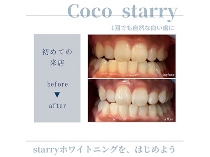 ココスターリー(Coco starry)の写真