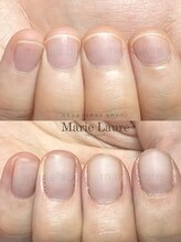 マリーロール 梅田店(Marie Laure)/自爪育成/深爪矯正/ネイルケア