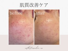 オートクチュール エステティックサロン シーズの雰囲気（肌質改善ケアで長年のお肌悩みも撃退★体験5500円）