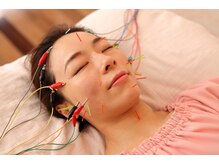 メイロン(meilong)/美容鍼灸