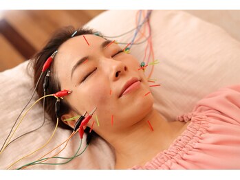 メイロン(meilong)/美容鍼灸