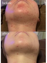 ベベ 金沢片町店(Be’be’)/その場で実感！ビフォーアフター