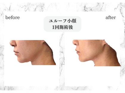 トキ(TOKI)の写真