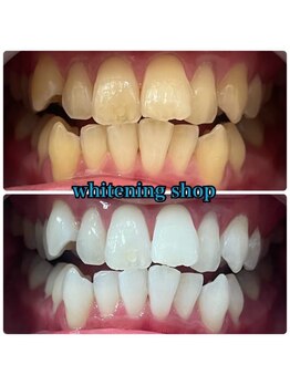 ホワイトニングショップ 豊橋店(WHITENING SHOP)/本来の生まれ持った歯へ！！豊橋