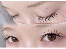 エヌアイズ(neYES!)/☆＆healthy100本☆