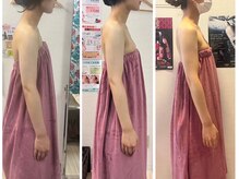 ロココ 岐阜店(Rococo)/姿勢から根本改善！バストアップ