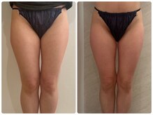 ルナグランデ 心斎橋店(Luna grande.)/前ハリも柔らかくなる