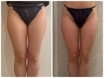 ルナグランデ 心斎橋店(Luna grande.)/前ハリも柔らかくなる