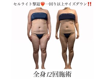 痩身革命 大宮店/ダイエットリンパマッサージ