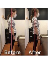 カワル整体 上通り院/脚だけ痩せない人の特徴