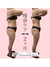 デマントイド 倉敷(Demantoide&Co)/オールハンド痩身