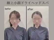 ラースパ アザブ(La SPA azabu)/La SPA麻布小顔ドライヘッドスパ