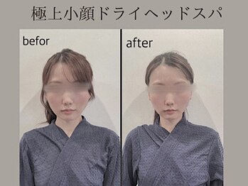 ラースパ アザブ(La SPA azabu)/La SPA麻布小顔ドライヘッドスパ