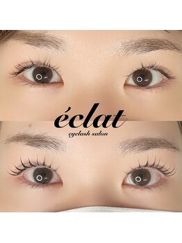 エクレ(eclat)/L3リフト