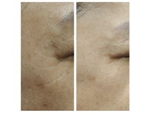 その他before→afterはフォトギャラリーをチェック♪