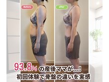 ママノ休日(Momの休日)の雰囲気（4ヶ月後の効果です。）