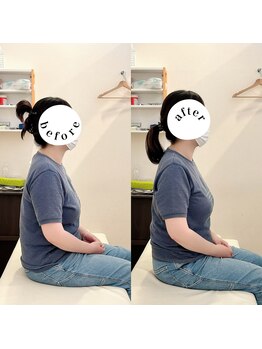 えにし整体 鍼灸整骨院/えにし式筋膜リリース整体