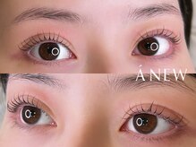 アニュー 目黒(ANEW)