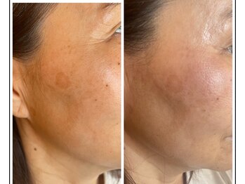 グランヴェルデ(GRAND VERDE)/肌が若返る体験を。