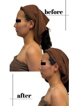 アロマフォーレ 水戸店(AromaForet)/巡りと癒し深めリンパマッサージ