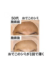 わ心美/ビフォーアフター