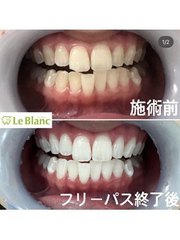 ルブラン 奈良店(Le Blanc)/定期的なメンテナンスを！