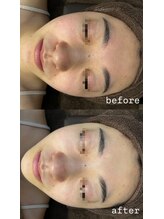 エクラ(ECLAT)/クールビタミン導入♪