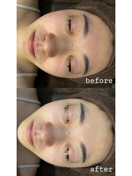 エクラ(ECLAT)/クールビタミン導入♪