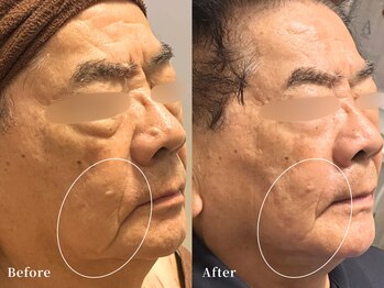 リジェ(Rege)の写真/《最高級のエイジングケア》肌の活性能力をエクソソームで最大限に引き出し速攻性＆持続性◎