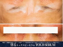 エヴァーグレース 栄店