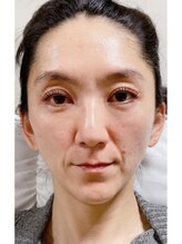 リアンボーテ(Lien Beaute)/まつげパーマ＆ヘッドスパ！