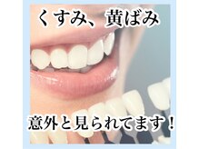 ホワイトニングサロン ホワイト(WHITE)/セルフホワイトニング/大阪/福島