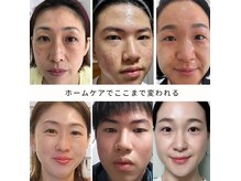 ホームケアのみでキレイを実感！韓国インセルダム正規取り扱い店