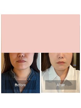 かぐや(salon)/ビフォーアフターのお写真 3回目