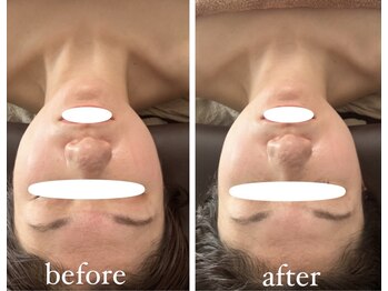 スラン(Slan)/輪郭チェンジ★