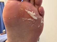 パッソ(Passo)/自然由来の成分で古い角質を除去