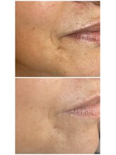 グランヴェルデ(GRAND VERDE)/上質な素肌を最短で。