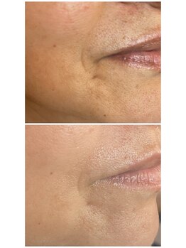 グランヴェルデ(GRAND VERDE)/上質な素肌を最短で。