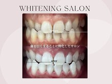 ホワイト つくば店(WHITE)/